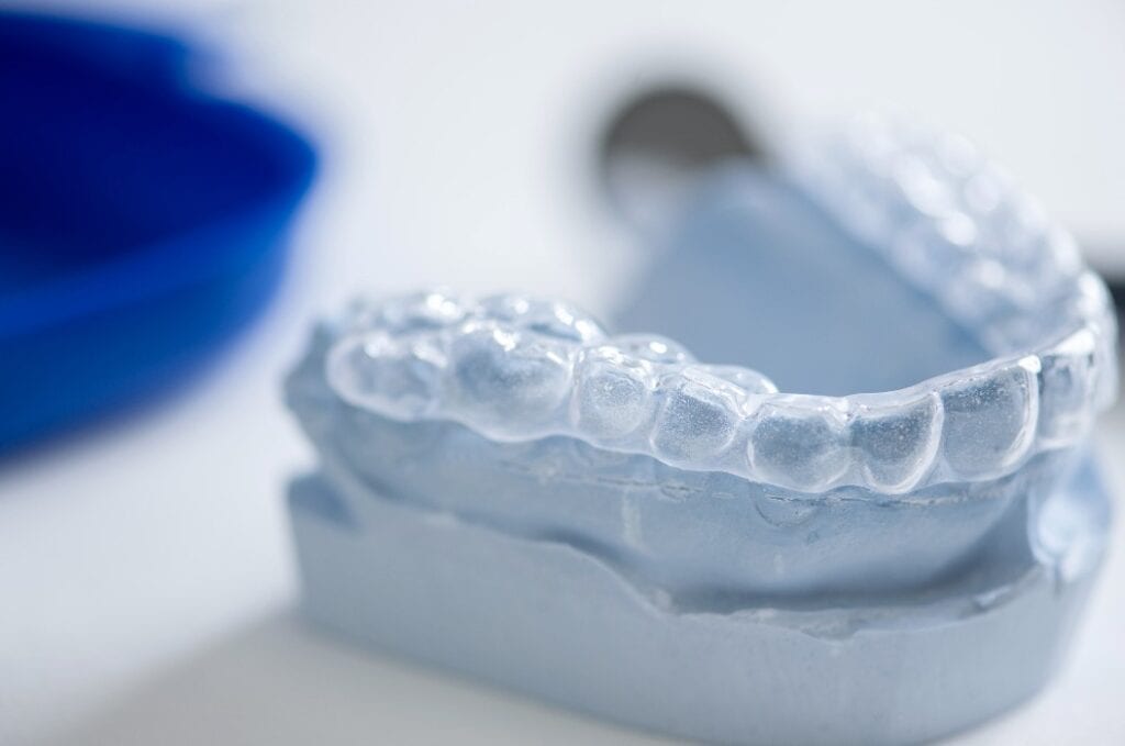 farblose Aufbisschiene auf Gipsmodell in der Zahnarztpraxis, Entlastung der Zahn- Muskel- und Gelenkfunktion