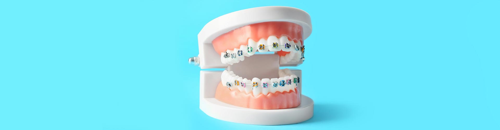 Model of jaw with braces on blue background with space for text